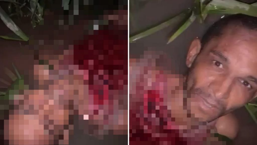 CENAS FORTES – Vídeo mostra homem logo após ser atac4do por uma onça no AM