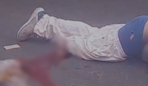 CENA FORTE: motociclista perde perna durante grave acidente em Manaus